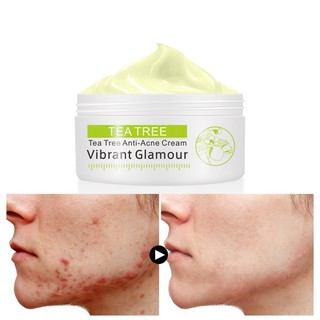 Top-Women Tea Tree Anti-Acne Cream Facial Cream pimple Removal Oil Control Blemishes Treatment Cream