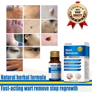 Warts Remover original Ointment Antibacterial face body acne treatment pimple remover cream herbal