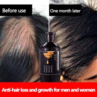 GaoTiya Ginger Hair Care Shampoo Hair treatment to prevent hair loss and rapid hair growth