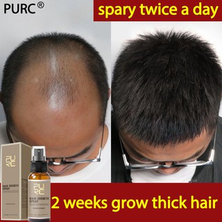 PURC Hair Growth Serum hair grower Hair Grower for Men Hair Growth Spray Essence Anti Hair Loss 30ml