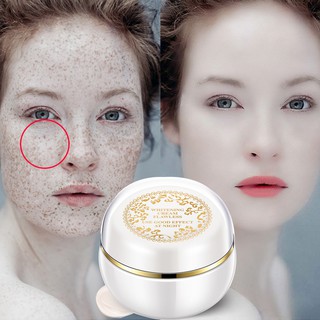 Lady Skin Cream Magic Glow Freckle Removal Whitening Cream Freckles Sunburn Plaques Pregnancy Remove