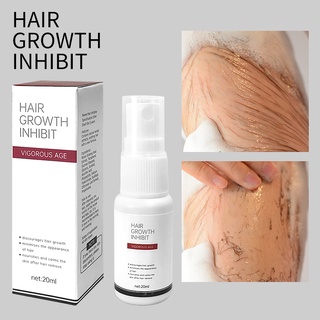 Hair Removal cream Permanent Fast Gentle Body Hair Remover Leg Hair Growth Suppression Spray PH