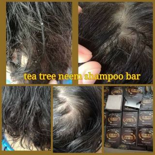Original cod Tea tree neem shampoo bar 135g (3)