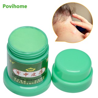 2Types Herbal Antibacterial Ointment Scabies Cream Psoriasis Eczema Dermatitis Treatment Itching