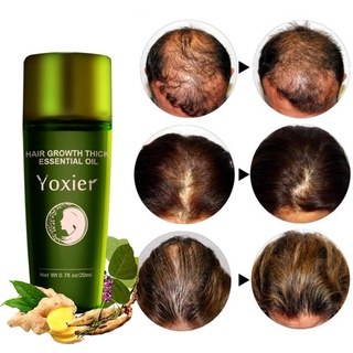 Hair Growth Serum Oil Shampoo Styling Prevent Hair Loss Product Thick Fast Repair Growing Liquid
