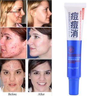 BUY BIOAQUA 30g Acne Comedo Pimples Removal Shrink Pore Moisturizing Skin Care Cream