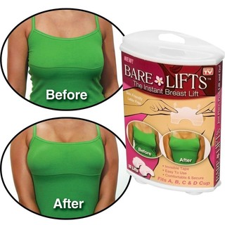 Bare Lifts (The Instant Breast Lift) (1)