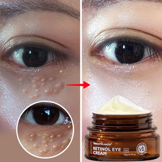 VIBRANT GLAMOUR retinol anti-aging eye cream to remove eye bags and dark spots Skin Care 20g (1)