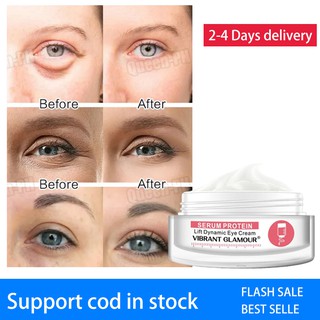 Eye Cream For Dark Circles Puffiness Wrinkles Most Effective Anti-Aging Eye Serum 3IYB
