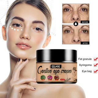 Natural Eye Cream Remove Dark Circle Bags Under The Eyes Prevent And Improve Fat Particles Improve (7)