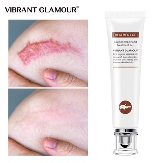 【Ready Stock】✗▪◙Vibrant Glamour scar removal Acne Cream Scar Cream Scars Repair Stretch Marks Pregna