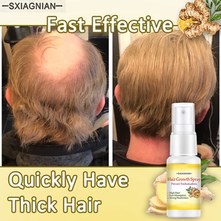 【SXIAGNIAN】Ginger Hair Growth Essence Oil Preventing Hair Loss Hair Grower For Men and Women （20ml）