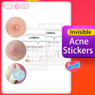 【COD】LANBENA Acne Pimple Patch Face Mask 28pcs Invisible Acne Stickers Blemish Treatment Pimple Remover Tool Skin Care Face Cream