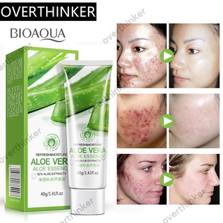 ℗BIOAQUA Aloe Vera Smooth Gel Acne Whitening Treatment Face Cream for Hydrating Moist Repair After