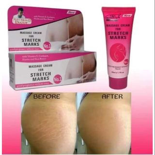 Herbal Skin Doctor Stretch Marks Cream CxX5 (2)