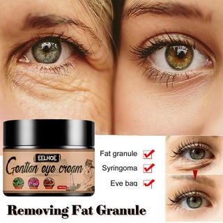 【spot goods】❃Natural Eye Cream Remove Dark Circle Bags Under The Eyes Prevent And Improve Fat Partic