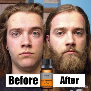 Hair Grower For Men Original Hair Growth Beard Growth For Men Beard Oil Men's Organic Hair Growth Li