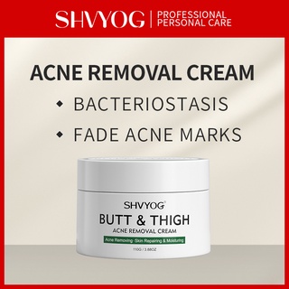 SHVYOG Acne Cream Freckle Cream Acvne Care Removing Acne Whitening Skin Suitable for All Skin Types (1)