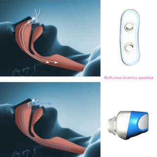 Anti Snoring Breathe Easy Sleep Aid Nasal Dilator Device (6)