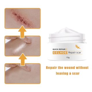 Scar repair ointment skin wound ointment scalding and desalting ointment operation repair scar (1)