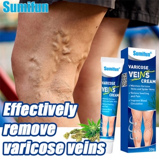 SUMIFUN Varicose Vein Remover Varicose Veins Relieve Ointment Anti- Varicose Treatment（20g）