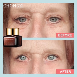 Eye Cream for Dark Circle Eyebag Dark Circle Remover Cream Eye Bags Wrinkles Removal Cream 20g