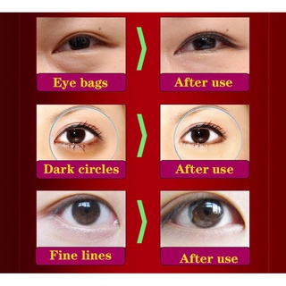 Rose eye cream moisturizing, hydrating, firming, diminishing dark circles and fine lines (5)