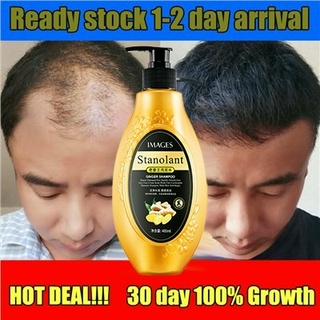 Ginger shampoo refreshing oil control soft Ginger Scalp Treatment Anti-Hair Loss hair grower (1)