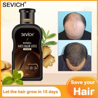 sevich Ginger shampoo Hair Growth Shampoo Anti Hair Loss Shampoo Anti Dandruff Shampoo Conditioner 0