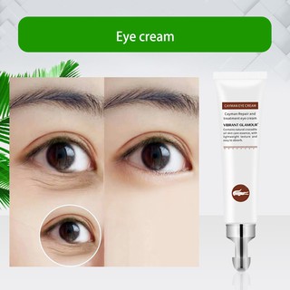 eye cream eye cream for dark circle and eyebag Moisturizing and wrinkle removal eye cream wrinkle (1)