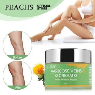 Varicose Vein Remover Cream PEACHS For Spider Varicose Vein Remover Natural Repair Beauty