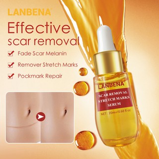LANBENA TCM Scar Removal Cream Acne Spots Treatment Whitening Stretch marks scar serum skincare (6)