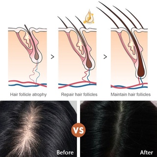 Hair Growth Essence Spray Anti Hair Loss Hair Care Hair Grower Oil For Men women Hair Dense Thicken (6)