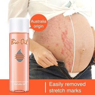 【Ready Stock】☍▩200ml Original Bio Oil Skin Care Ance Stretch Marks Remover Cream Remove Body Uneven (1)