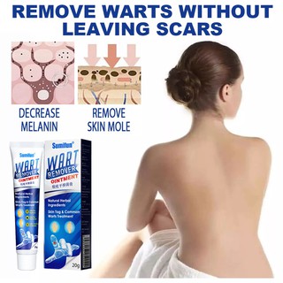 Body Warts Remover Cream Skin Tag Remover Corn Plaster Antibacterial Warts Ointment