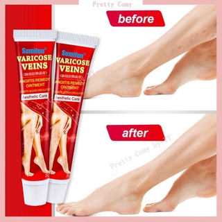 Authentic Sumifun Leg Cream For Varicuse Veins Solution