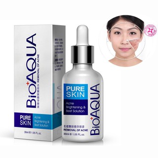 ♕ exo ღ BIOAQUA Face Care Acne Spots Acne Scar Removal Moisturizing Essential Oil 30ml