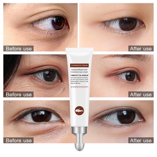 VIBRANT GLAMOUR Eye Cream Hyaluronic Acid Eye Gel Effective Whitening Anti-Wrinkle Anti-aging