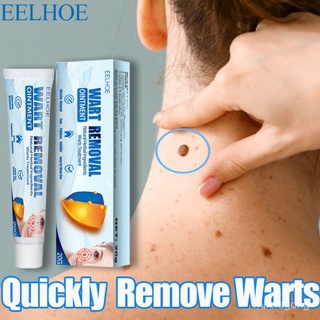 【EELHOE】Warts Remover Original Cream Skin Tag Remover Original Warts Removal Effectively Remove Comm