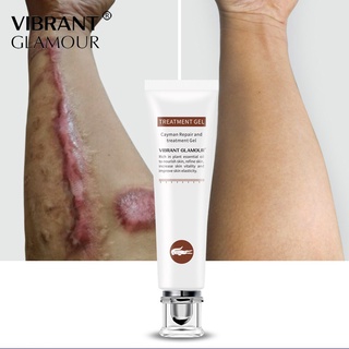 【remover cream】 VG Scar Remover Acne Scar Cream Scars Repair Stretch Marks Pregnancy Scalded Surgery