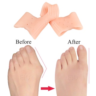 EiD Orthotic Insoles Silicone Gel Toes Separator fot Hallux Valgus Toe Correction Cushion Forefoot