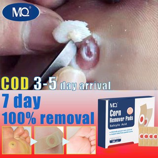 foot and finger care✆24PCS Warts remover Foot Corns Remover Patch To remove calluses on the feet Pa