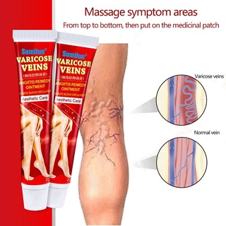 20g Sumifun Varicose Cream Ointment Pain Relieving first aid skincare medical Vasculitis health oil