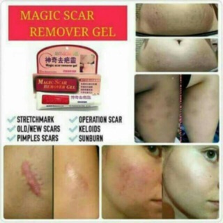 Styleclub Buy 1 Take 1 Magic Scars Remover Gel (4)