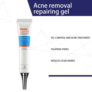 pimple remover acne marks remover skin care products anti Acne Treatment Face Serum Anti-Acne Facial