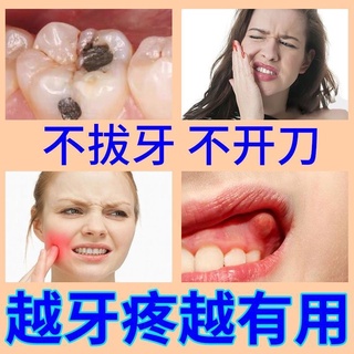 Analgesic spray❧Toothache special medicine for quick pain relief, worm tooth cavity, gum swelling an