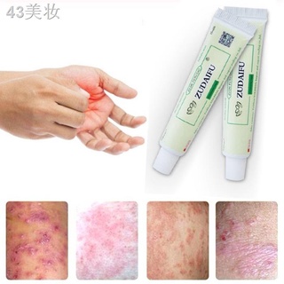 ☢┇♗Effective 15g Skin Care Product Relieve Psoriasis Dermatitis Eczema Pruritus Effect Zudaifu Body