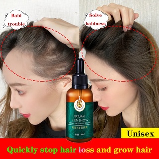 Hair Growth Serum Ginger Hair Treatment Essence Anti Hair Loss Spray Essential Minoxidil Fast Grower