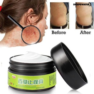Effective Herbal Ointment Dermatitis Psoriasis Eczema Cream Anti Itch