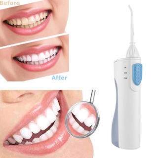 ✈✽Oral Irrigator Water Dental Flosser Portable Floss Water Jet Toothbrush Teeth Cleaning Machine SPA
